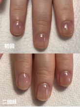 ハンド ケイ(Hand K)/自爪育成