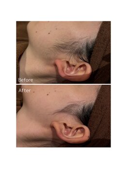 オアシスサカエ(OASIS SAKAE)/【もみあげ脱毛】(sパーツ)