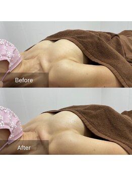 ルナリア ルクス 志木南口駅前店/バストケア＆バストアップ