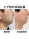 猫の手の写真/【効果に自信あり】都度払い制で通いやすい♪男性もお子様も◎美肌効果とスピード施術が魅力！初回30%OFF★