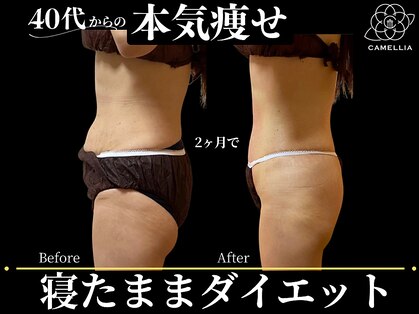 リラクビューティー カメリア(Camellia)の写真