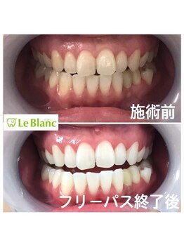ルブラン 奈良店(Le Blanc)/本気で白くしませんか??