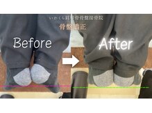 いわくら肩甲骨 骨盤接骨院BTG 一宮千秋/骨盤矯正・足関節矯正　3