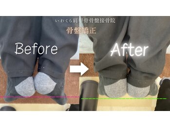 いわくら肩甲骨 骨盤接骨院BTG 一宮千秋/骨盤矯正・足関節矯正 3