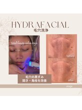 ステージ(Stage)/毛穴洗浄・ハイドラフェイシャル