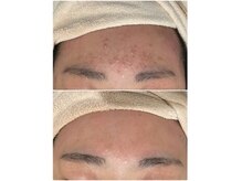 エンフィール(&.Feel)の雰囲気（肌トラブルも改善へ導く結果重視の本格ケア！）