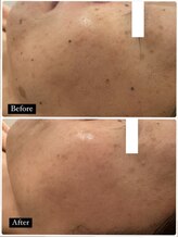 ミラ(Mila)/BeforeAfter☆