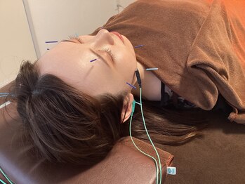 ハリファ鍼灸院 横浜関内院(HariFa鍼灸院)/美容施術・美容鍼