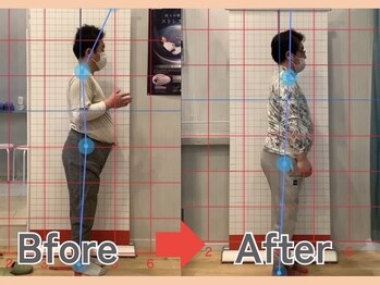 もにわ接骨院/４０代男性２４回施術で症状改善