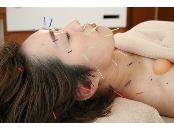 ジネン(ZiNEN)/美顔鍼