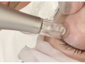 香嬉琉/瞼のたるみ、目頭、目尻のシワに