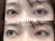 ブルックアイルーム(BROOK eye Room)の写真