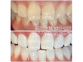 ホワイトニングルーム 横浜店(Whitening Room)/セルフホワイトニング/横浜
