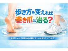 巻き爪じゅん 千葉駅前店/歩き方変えると巻き爪改善する？