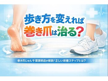 巻き爪じゅん 千葉駅前店/歩き方変えると巻き爪改善する？