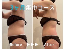 エピデリ 福岡大濠(EPI de RIZ)/【痩身/ダイエット】３ヶ月集中