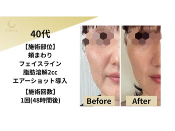 クレビア(Clevia)/Clevia-クレビア-