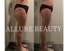 アリュールビューティー 下高井戸店(ALLURE BEAUTY)/90分15回モニター様