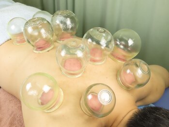 湧成堂鍼灸整骨院/吸玉