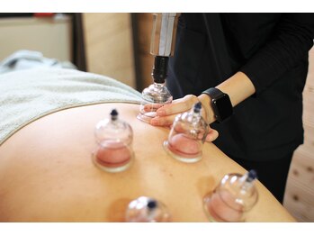 鍼灸治療院 森空堂 本院/通常施術にカッピングをプラス！