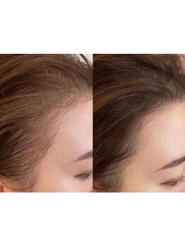 ヘッドスパで癒されたい