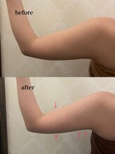 オアシス カナヤマ(Oasis kanayama)/【痩身】すっきり！