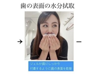 ホワイトニングショップ 明石大久保店/◎歯の水分をティッシュオフ