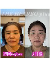 ハーボプラス(THE HEARBO plus)/2日目は別人ですね