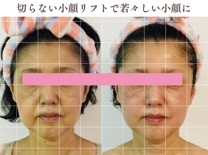 小顔コルギアンドフェイシャルサロン ジュエル(JEWEL)の写真