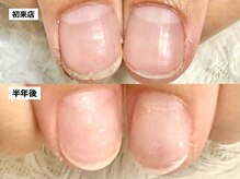 グレースレディ/継続がもたらす美しい爪