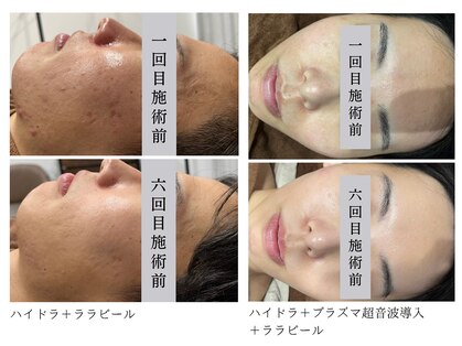 ナーススキン(nurse skin)の写真