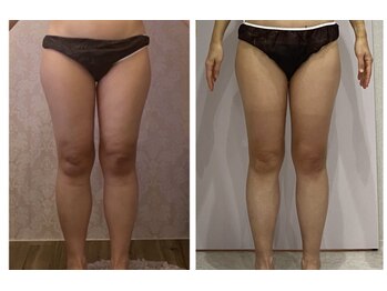 ルポーゼ(Repose)/