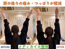 四条大宮アシスト鍼灸整骨院/全身整体ビフォーアフター