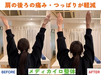 四条大宮アシスト鍼灸整骨院/全身整体ビフォーアフター