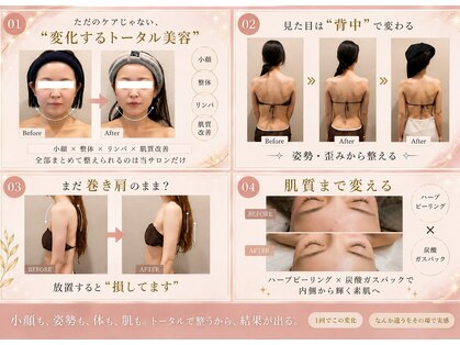 小顔フェイスラボ 姫路店(小顔 Face Labo.)の写真