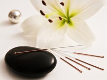 タオ 京都烏丸(TaO)/ほうれい線たるみのケアに美容鍼