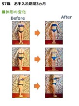 クリアー(clear)/ダイエットビフォーアフター