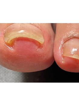 爪の悩みを解消できる（ケア含む）