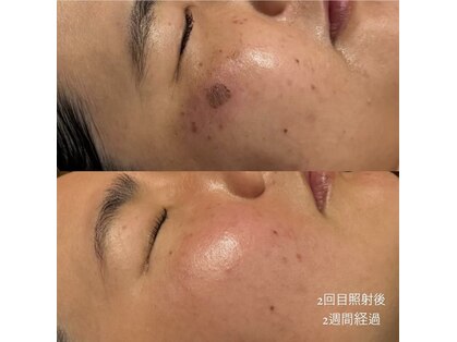 ビセラ(Vicella)の写真