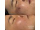 ビセラ(Vicella)の写真
