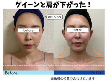 お顔の研究所/ビフォーアフター写真♪