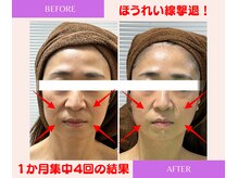 ユーフォリア(Euphoria)