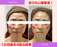 ユーフォリア(Euphoria)