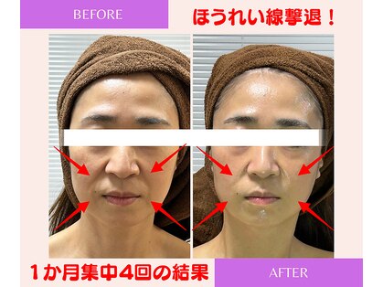 ユーフォリア(Euphoria)の写真