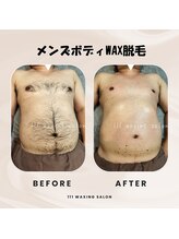 トリプルワン(111)/メンズボディWAX脱毛