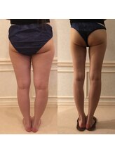 ラルーナ(La Luna)