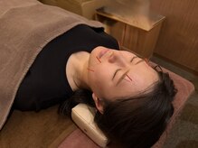 門司駅やわらぎ鍼灸整骨院/美容鍼