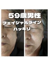 リボーン(Reboorn)/CS60フェイシャル