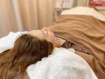 こじま 富雄団地接骨院/美容鍼