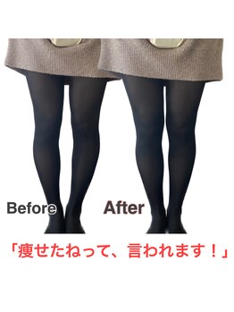 鍼灸マッサージ院 ゲン(GEN)/O脚改善★結果写真